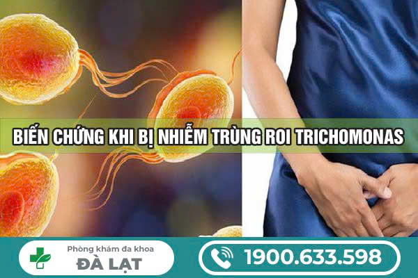 Hình ảnh minh họa